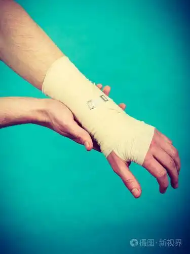 那痛苦缠着绷带的手照片-正版商用图片02wk7g-摄图新视界