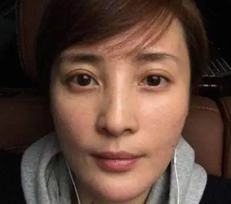 不少明星都离开化妆,张雨绮卸妆后脸部发肿,吴亦凡让人大跌眼镜