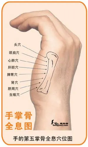 【第二第五掌骨全息图】
