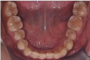 口腔美学临床影像规范介绍和解读_kq88口腔管理网