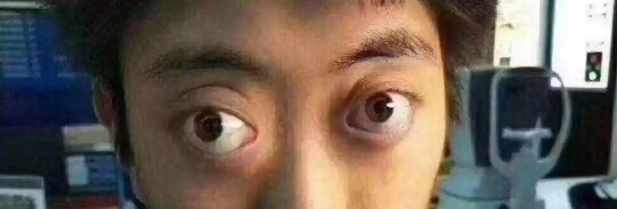 近视是怎么形成的,为什么近视眼球会突出