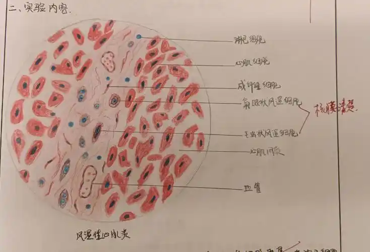 病理学切片红蓝铅笔图