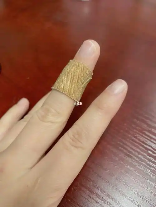 早上,手突然破了一个小口.