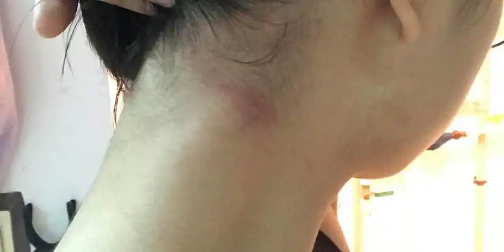 我死了一只蟑螂在我手上爬