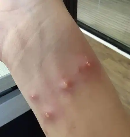 红火蚁杀伤力极强,已传播至我国435个县市区