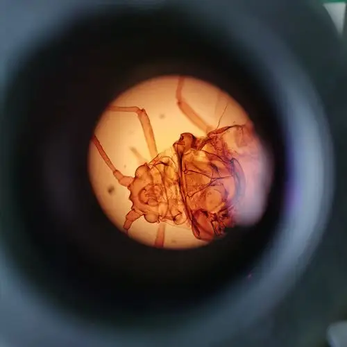 显微镜下的蚜虫切片放大400倍和100倍