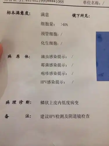 鳞状上皮内低度病变是什么意思啊?严重吗?好不好治疗啊?