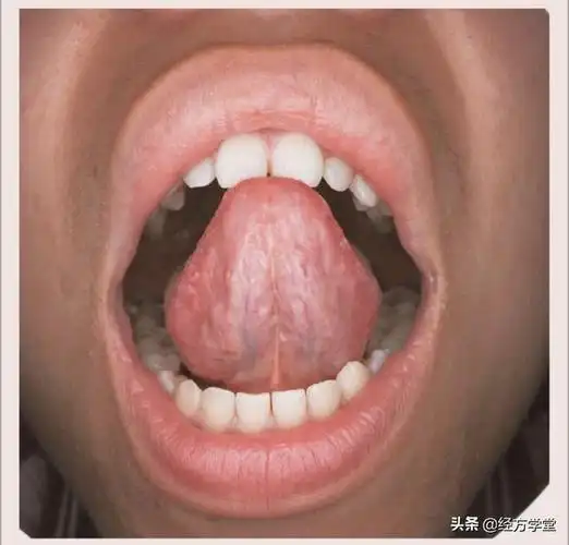 【经方学堂】,一起学习舌诊,教您如何看舌,怎样看?