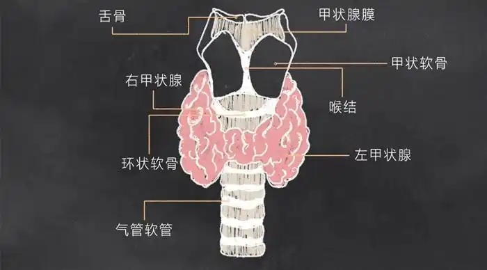 指甲状腺细胞在局部异常增生所引起的一个或多个组织或结构异常的团块