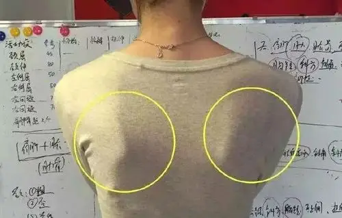 明星苑30岁的张雨绮和37岁谢娜撞衫她怎么输得这么惨