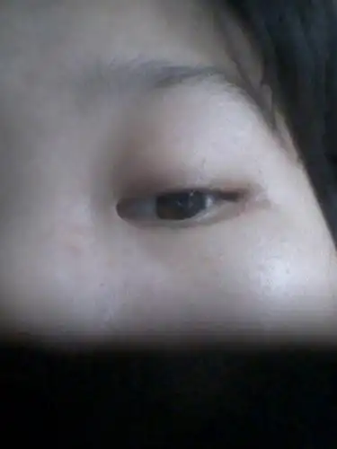 眼角发黑,该用什么化妆品比较好?