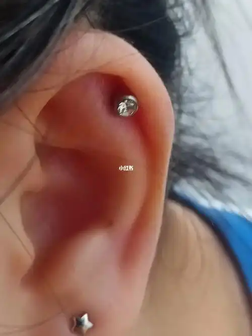 出血了p1p2是27号耳洞开始发炎29号看医生,开始擦碘伏31号不疼不肿了