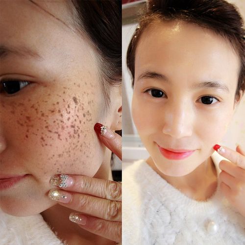 增白霜美白面部淡化去除黑色素沉淀脸部色斑脸上祛斑洗面奶套正品