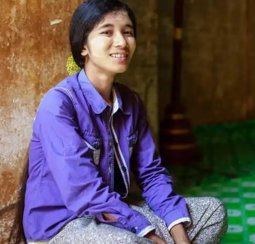 中缅边界的缅甸女孩,个个如出水芙蓉,唯独这一个缺陷太过遗憾!