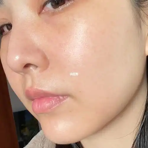 32岁的真实皮肤雀斑还算细腻就是肤色暗