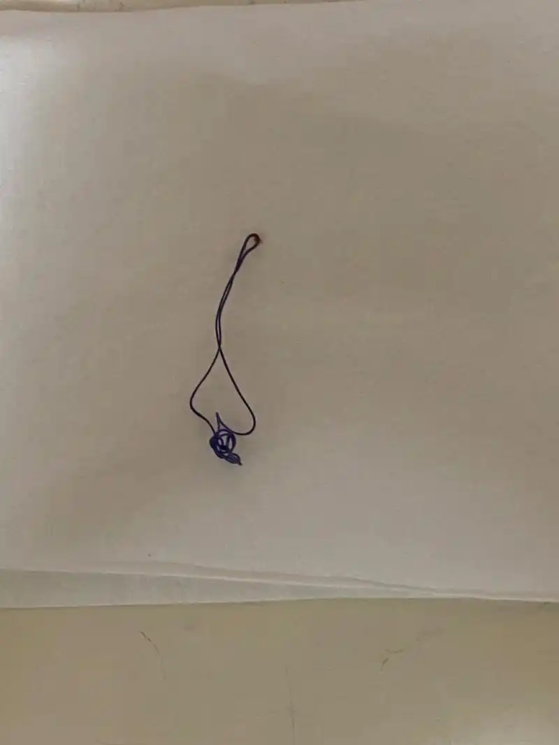 痔疮术后第十六天 刚才洗完澡涂药的时候,门口的线轻轻一拉就掉了