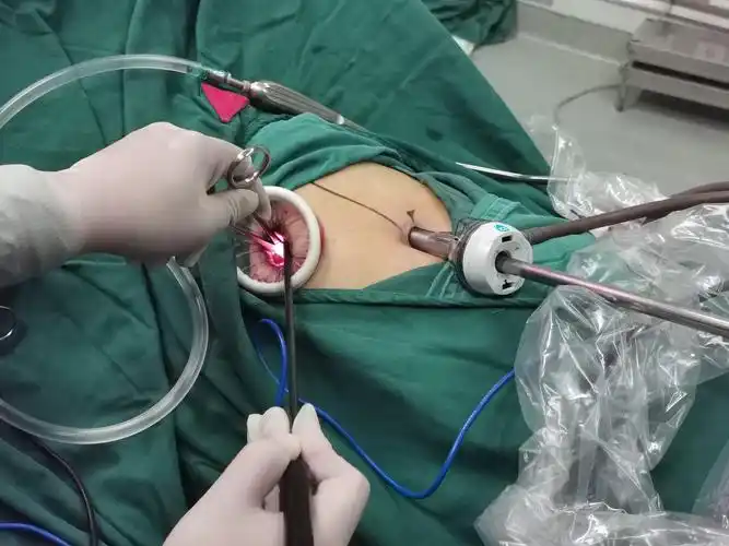 微创胸腔镜肺结节手术简介早期肺癌磨玻璃结节肺结节手术过程介绍