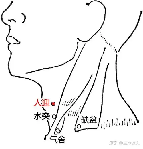 取穴:穴位于人迎脉部位.