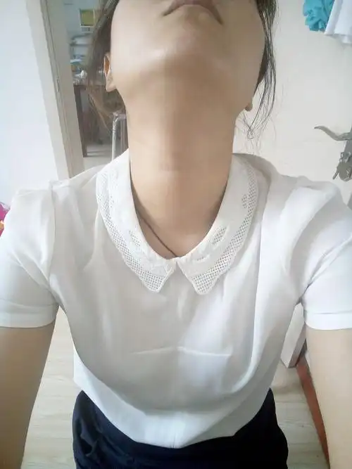 脖子粗 我想问下这是甲状腺有问题吗 如果有属于几度甲状腺肿呢