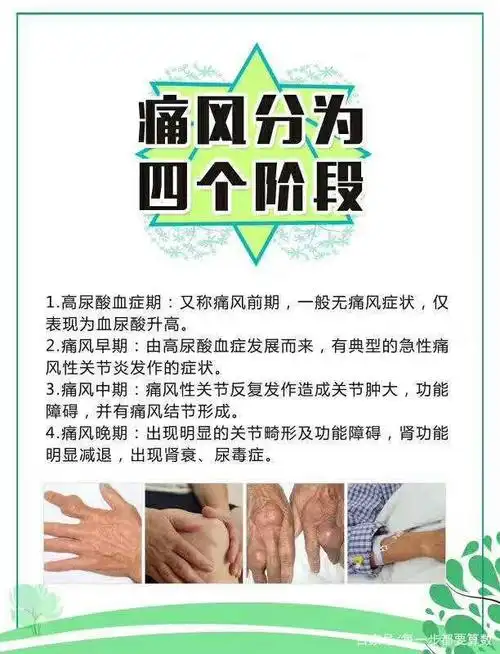 痛风阶段,每向前迈进一个阶段,就如同从悬崖向下摔下一个层面