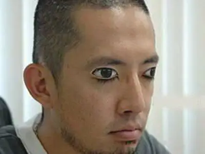 张飞病:张著眼睛睡觉是怎麼回事?