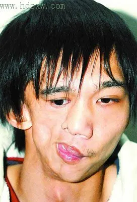 武汉男子有张"阴阳脸"