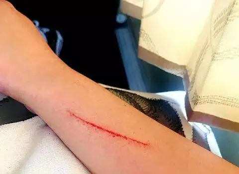 蔡徐坤脑残粉晒刀伤警告黑粉再黑坤坤就割腕网友惹不起