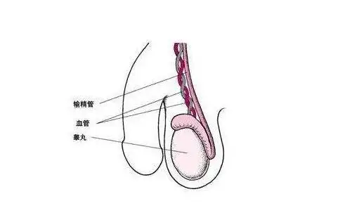 输精管堵塞的症状有哪些?怎么检测 - 相因问答
