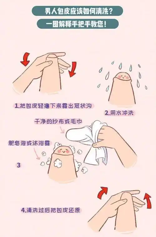 丁丁里隐藏的白色豆腐渣样的东西是什么?_包皮_龟头_男性