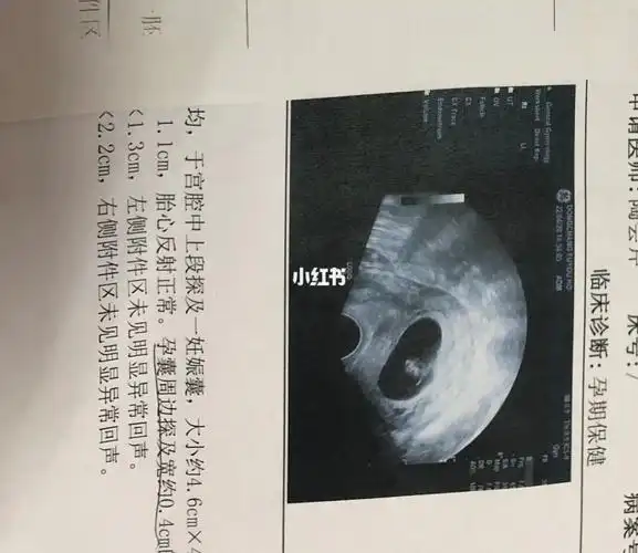 这样的孕囊是男孩还是女孩姐妹帮忙看89