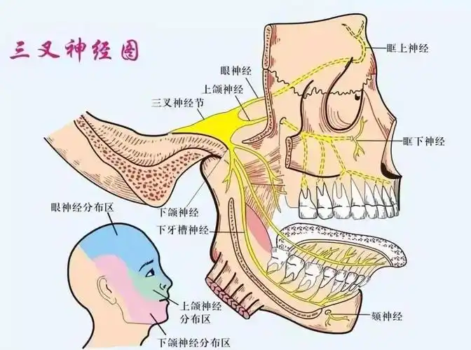 韩素勤介绍,三叉神经痛是常见多发病,从解剖结构上来讲, 支配牙齿感觉