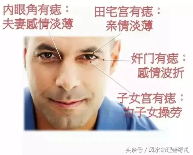 眼头有痣代表什么(眼旁有痣的具体面相讲解)