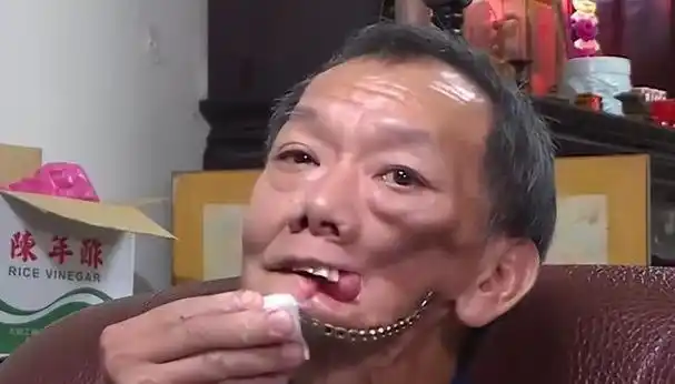 槟榔虽好不要贪,一天三包命难延.阎王若坐你身旁,只因槟榔嚼太勤.