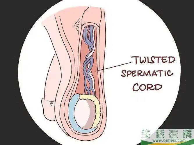 睾丸里面长有硬块为什么 睾丸上面有硬块是什么情况