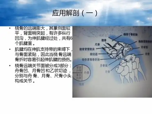 桡骨远端骨折colles骨折概述ppt