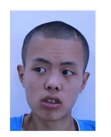 急寻线索:北京海淀20岁小伙急寻家属,患智力障碍,高1米78