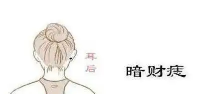 耳朵后有痣的图