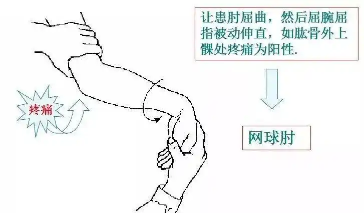运动必备90的运动损伤检查法都在这篇文章里