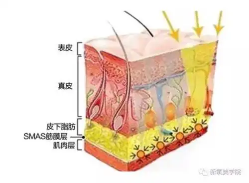 人体组织的分布规律是:最内层是骨骼,然后是肌肉,肌肉上面是smas筋膜