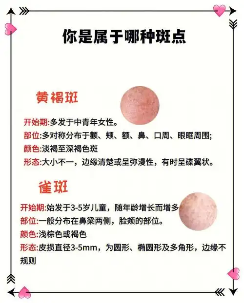 斑点的分类60你是属于哪种斑呢63