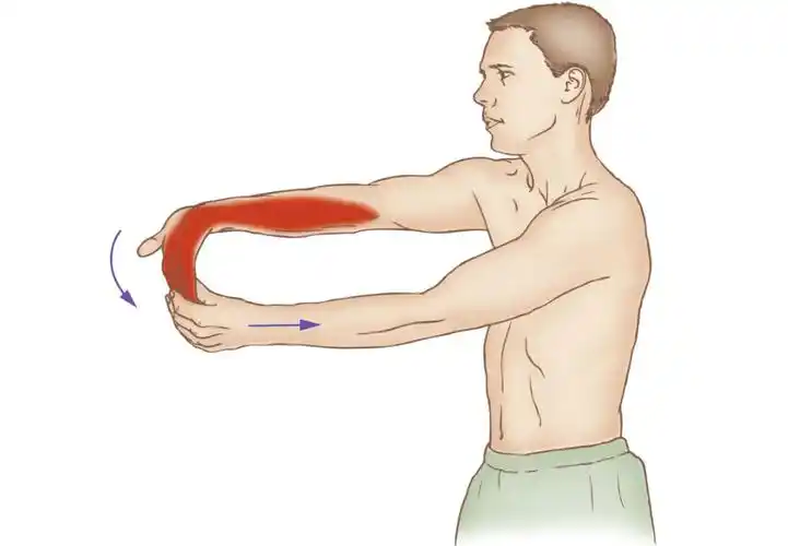 如何辨别旋前圆肌综合征不是腕管综合征?_前臂_压迫_手肘