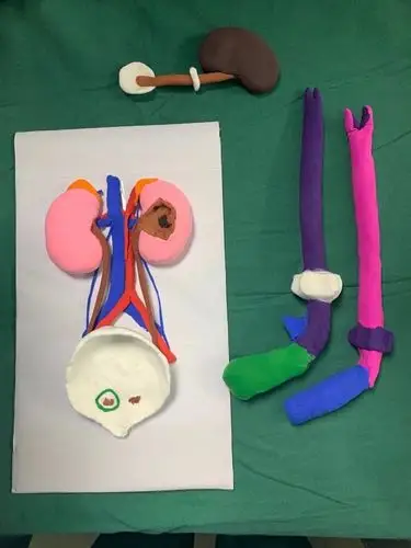 泌尿外科牛建强医生协助制作黏土器官模型