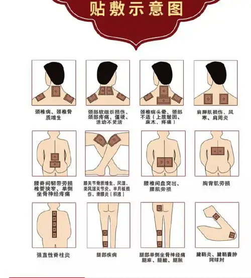 9】南京同仁堂 蜂毒远红外贴10贴,可以活血化瘀,通经活络,缓解颈肩