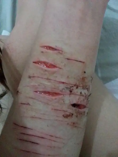 割到这种地步什么时候才能好起来?