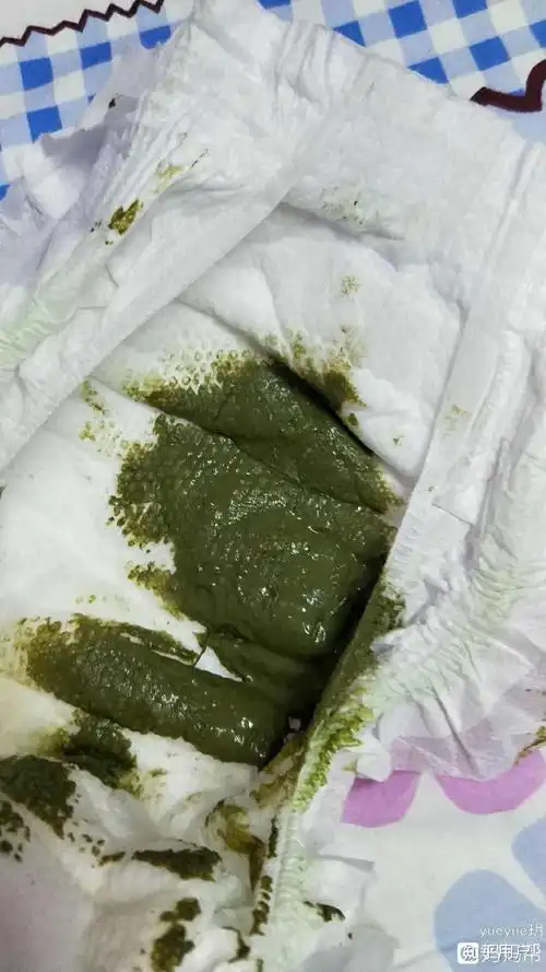 为什么孩子的大便总是绿色的