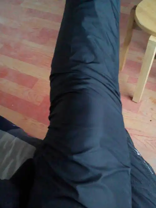 小腿部有明显弯曲有什么办法可以矫正吗?_百度知道