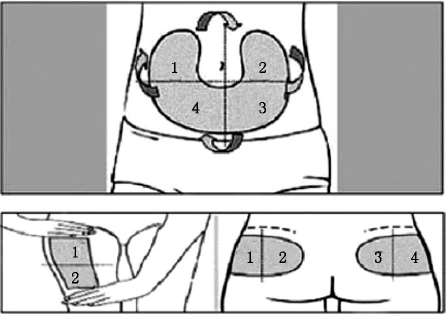 注意事项5个方面搞懂胰岛素注射