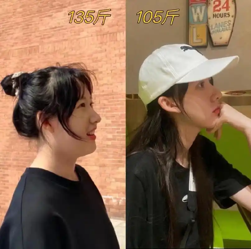 女子瘦了30斤以后侧脸的变化