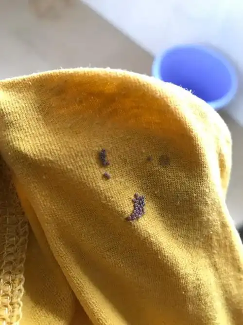 评论  这是某种虫卵 小心有毒或者有细菌 不要去挤了 把它弄掉 衣服