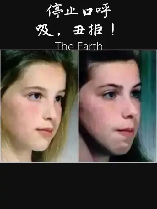 矫正口呼吸,拒绝变丑